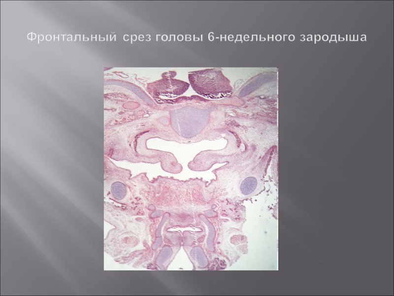 Фронтальный срез головы 6-недельного зародыша